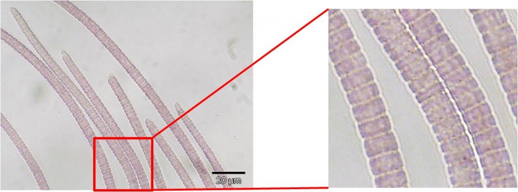 Picture taken through a microscope showing the cyanobacteria